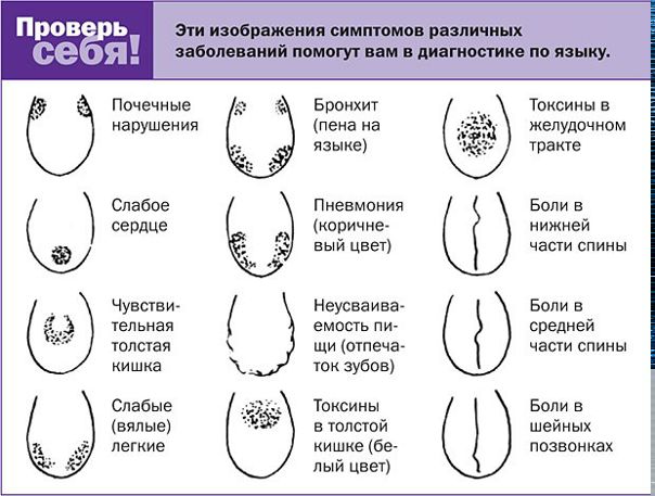 ВАШ ЯЗЫК КАК ИНДИКАТОР, ПОМОГАЕТ ОПРЕДЕЛИТЬ БОЛЕЗНИ 