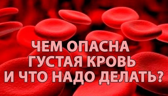 ЧЕМ ОПАСНА ГУСТАЯ КРОВЬ И ЧТО НАДО ДЕЛАТЬ 