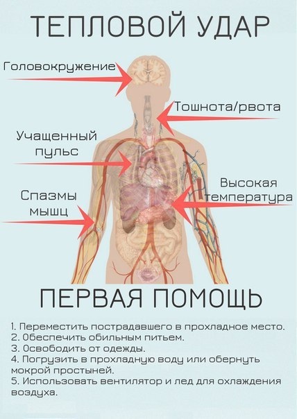 Тепловой удар. Первая помощь 
