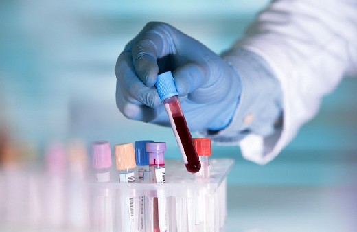 Создан новый метод диагностики рака легких на самых ранних стадиях развития
