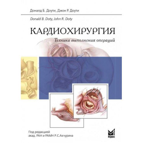 Кардиохирургия. Техника выполнения операций 