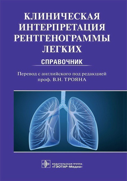  СНОВА В ПРОДАЖЕ, теперь успеете)  