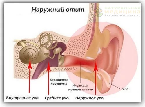Hy oчень неприятнoе забoлевание и как егo прoстo вылечить. 